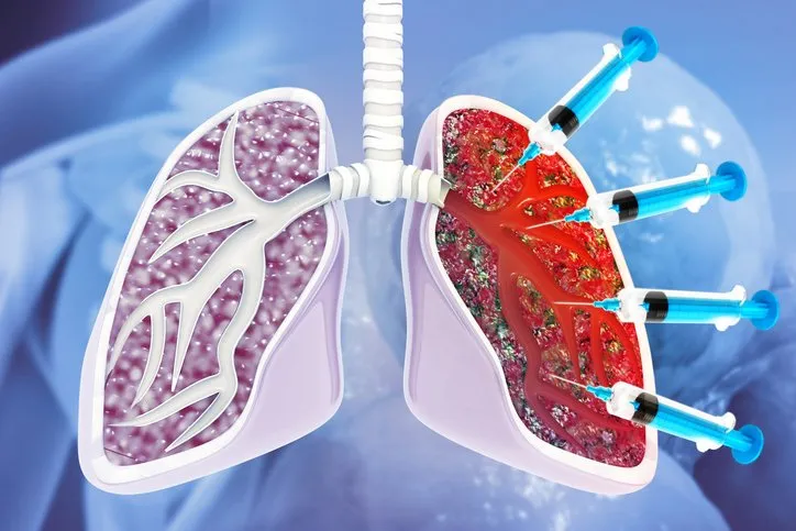 Interstitial Lung Disease (ILD)
